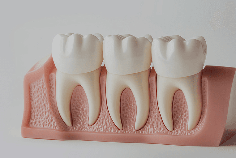 Root anatomy model used to explain root canal treatment