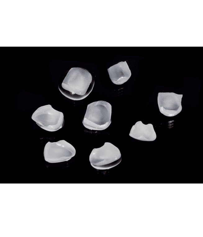 Individual ceramic veneer restorations